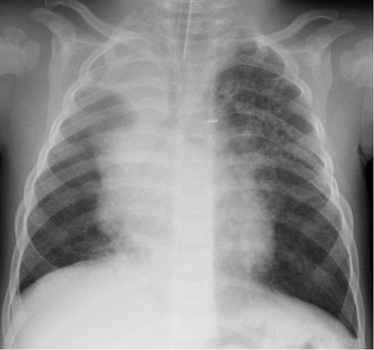 https://cdn.ncbi.nlm.nih.gov/pmc/blobs/b8c6/3739498/4c51d62733ee/13-0074-F.jpg