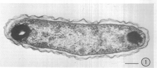 https://cdn.ncbi.nlm.nih.gov/pmc/blobs/b8c8/285233/fceb5f5b2e4c/jbacter00579-0458-a.jpg