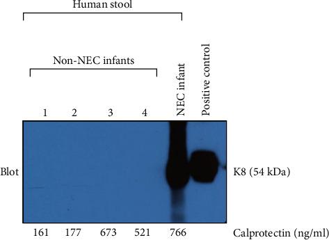 https://cdn.ncbi.nlm.nih.gov/pmc/blobs/b8ca/10030213/17f4e8319a32/JIR2023-5356646.005.jpg