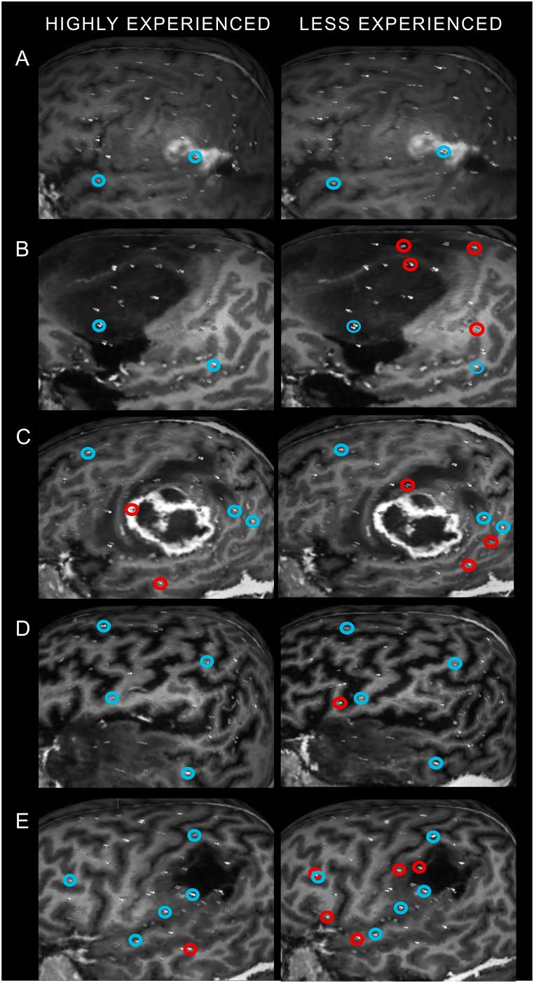 https://cdn.ncbi.nlm.nih.gov/pmc/blobs/b8da/10692765/4f8ef7ab4c83/gr1.jpg