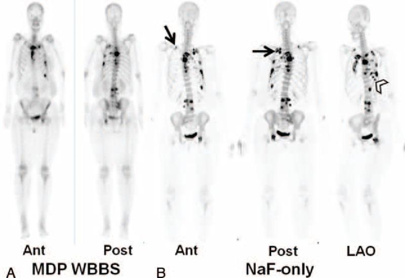 https://cdn.ncbi.nlm.nih.gov/pmc/blobs/b8e1/4554036/03ffce6bdc55/medi-94-e687-g001.jpg