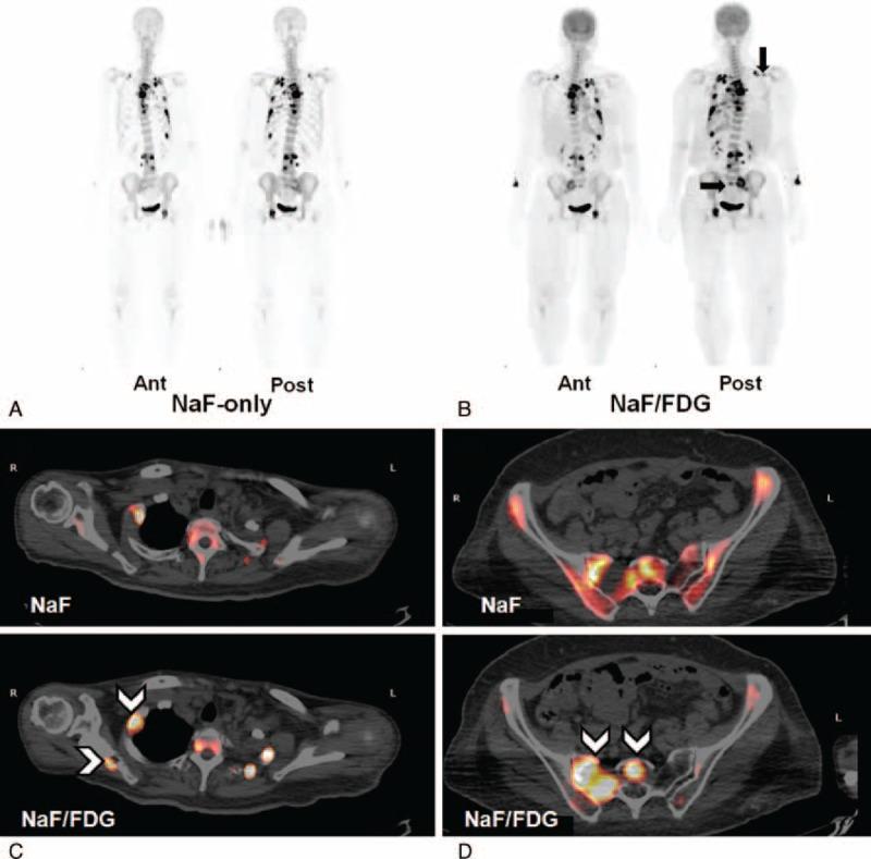 https://cdn.ncbi.nlm.nih.gov/pmc/blobs/b8e1/4554036/432d495f9742/medi-94-e687-g002.jpg