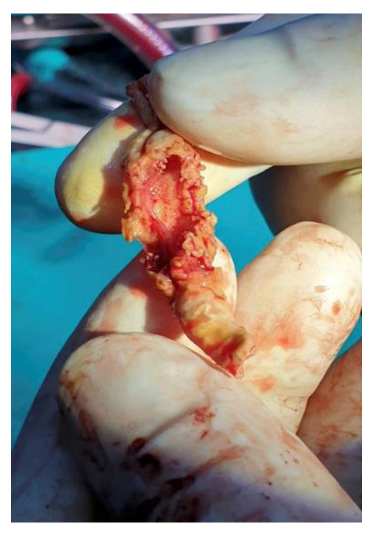 https://cdn.ncbi.nlm.nih.gov/pmc/blobs/b8e6/9570338/01a6f0e3f1bf/ijms-23-11127-g006.jpg
