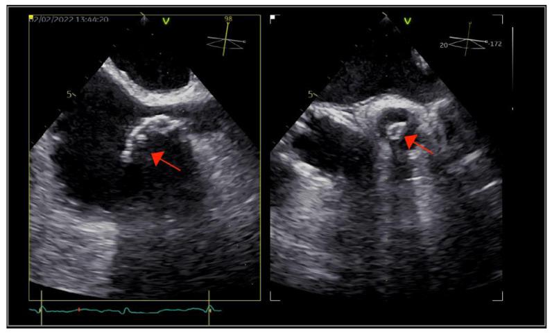 https://cdn.ncbi.nlm.nih.gov/pmc/blobs/b8e6/9570338/91a33c47923e/ijms-23-11127-g002.jpg