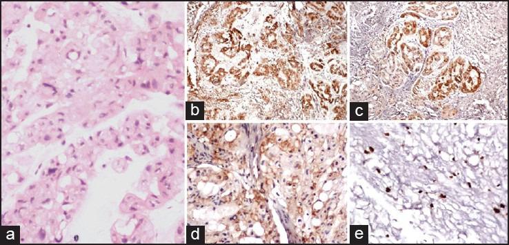 https://cdn.ncbi.nlm.nih.gov/pmc/blobs/b8e8/4944364/ee932394180a/JPGM-61-32-g003.jpg