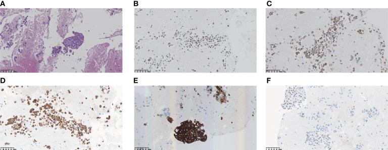 https://cdn.ncbi.nlm.nih.gov/pmc/blobs/b8e9/10111186/f2ba6e1db10a/fonc-12-998545-g002.jpg
