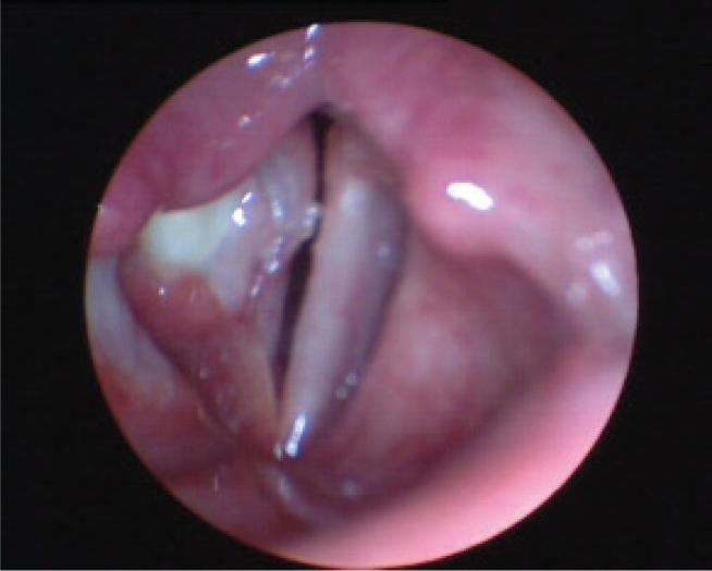 https://cdn.ncbi.nlm.nih.gov/pmc/blobs/b8ea/5329800/20f480d607ef/j_med-2016-0013_fig_001.jpg
