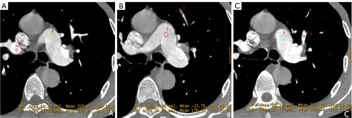 https://cdn.ncbi.nlm.nih.gov/pmc/blobs/b8f0/12209638/db21654c5f5b/qims-15-06-5593-f2.jpg