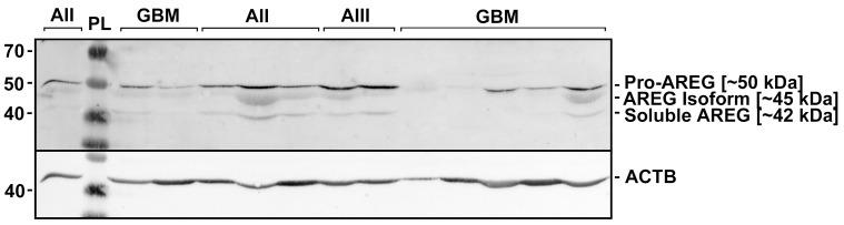 https://cdn.ncbi.nlm.nih.gov/pmc/blobs/b8f0/6485216/17de50a4357e/jcav10p1479g003.jpg