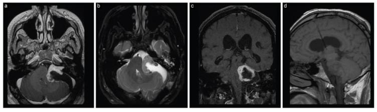 https://cdn.ncbi.nlm.nih.gov/pmc/blobs/b8f3/10669422/4d51d6234524/brainsci-13-01548-g002.jpg