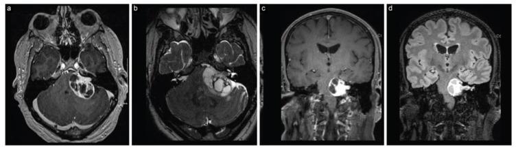 https://cdn.ncbi.nlm.nih.gov/pmc/blobs/b8f3/10669422/723eec38b4a6/brainsci-13-01548-g004.jpg
