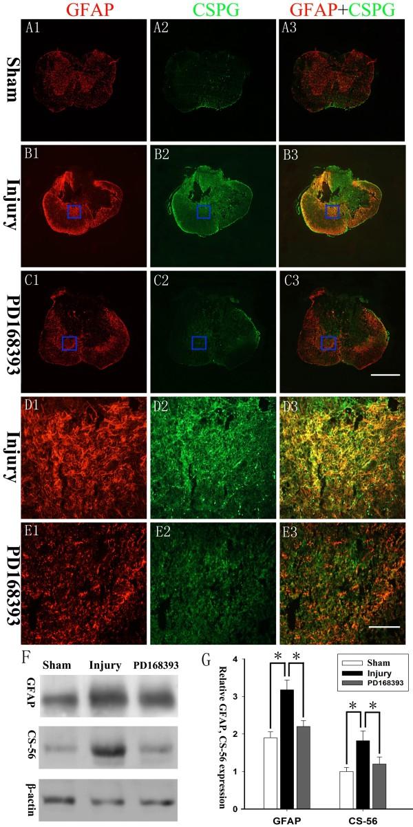 https://cdn.ncbi.nlm.nih.gov/pmc/blobs/b8f6/4030311/1b81464c7974/1742-2094-11-71-5.jpg