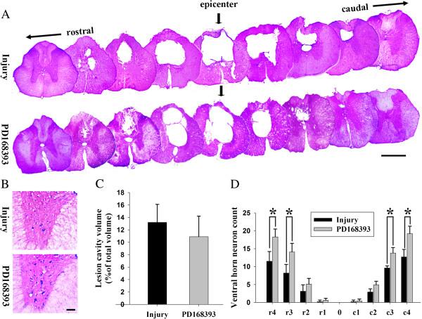 https://cdn.ncbi.nlm.nih.gov/pmc/blobs/b8f6/4030311/a8f5fb8cbf48/1742-2094-11-71-7.jpg