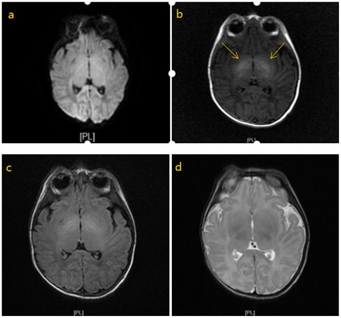 https://cdn.ncbi.nlm.nih.gov/pmc/blobs/b8f8/7480122/fcb7c90e687c/etm-20-05-09179-g02.jpg