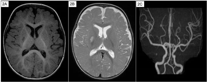 https://cdn.ncbi.nlm.nih.gov/pmc/blobs/b8fa/6824157/64dd64b5558e/egi10W5ZF7DC4F.jpg