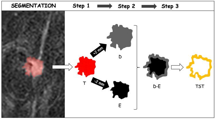 https://cdn.ncbi.nlm.nih.gov/pmc/blobs/b8fd/10287859/e56207bcbd19/10278_2023_781_Fig2_HTML.jpg
