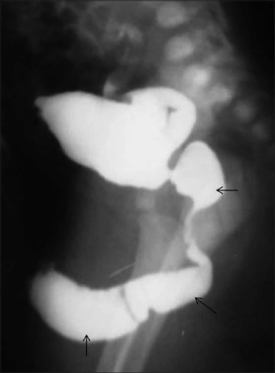 https://cdn.ncbi.nlm.nih.gov/pmc/blobs/b909/3056369/db507887f450/IJRI-21-38-g018.jpg