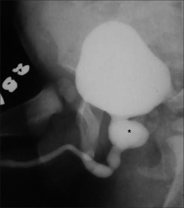 https://cdn.ncbi.nlm.nih.gov/pmc/blobs/b909/3056369/e09bc1d58977/IJRI-21-38-g013.jpg