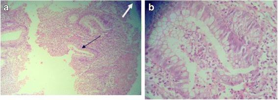 https://cdn.ncbi.nlm.nih.gov/pmc/blobs/b90c/5909273/4f26c0bda83e/12957_2018_1385_Fig1_HTML.jpg