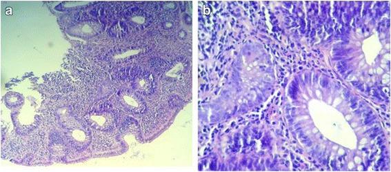 https://cdn.ncbi.nlm.nih.gov/pmc/blobs/b90c/5909273/e1f96d027015/12957_2018_1385_Fig3_HTML.jpg