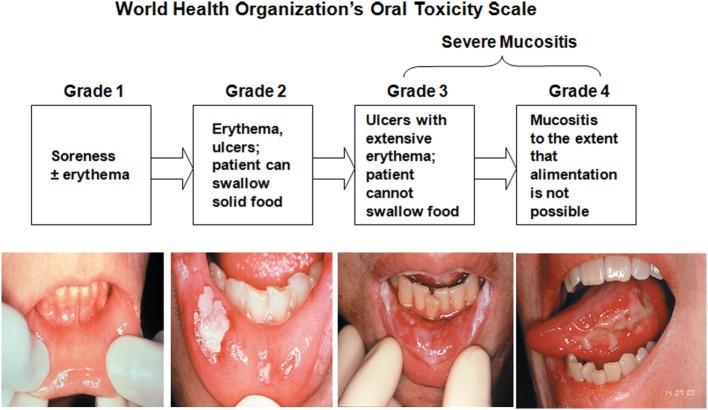 https://cdn.ncbi.nlm.nih.gov/pmc/blobs/b90e/5439125/7b6bd0de717d/fonc-07-00089-g004.jpg