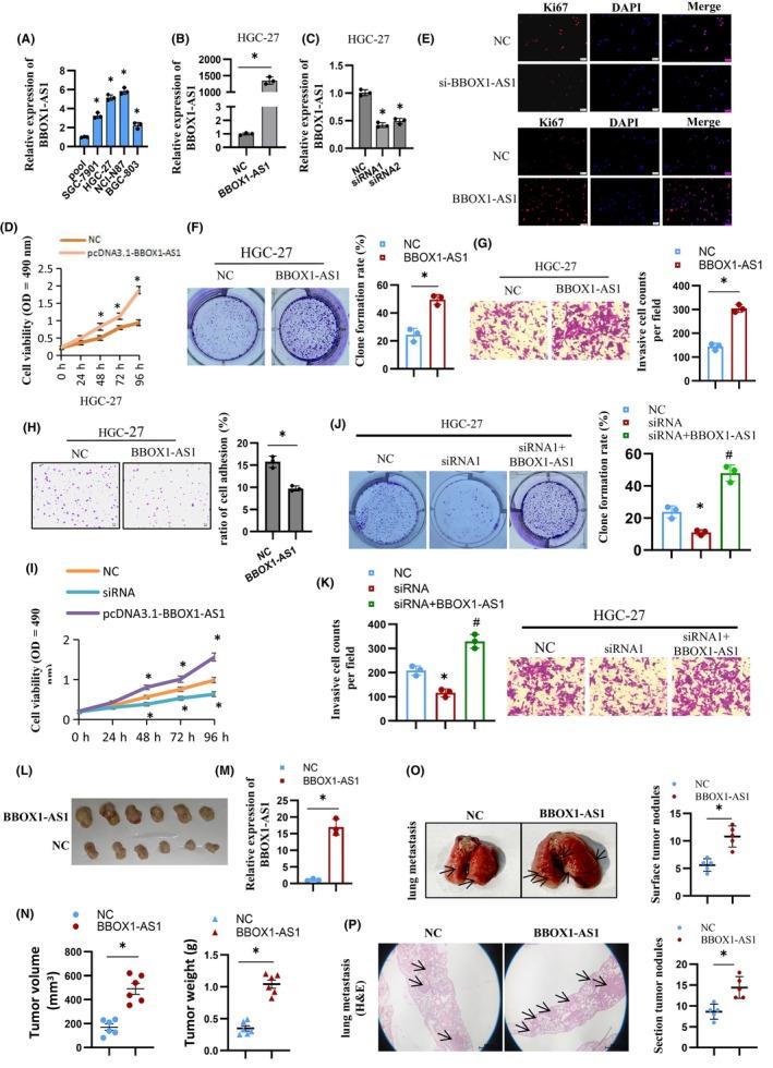 https://cdn.ncbi.nlm.nih.gov/pmc/blobs/b912/11611761/3716b3caf3a8/CAS-115-3875-g008.jpg