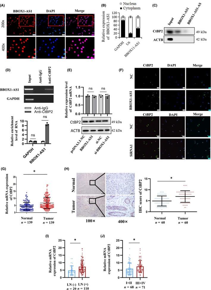 https://cdn.ncbi.nlm.nih.gov/pmc/blobs/b912/11611761/cd378d350ffd/CAS-115-3875-g007.jpg