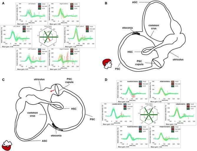 https://cdn.ncbi.nlm.nih.gov/pmc/blobs/b917/7593380/3adc1e5737e0/fneur-11-578588-g0014.jpg