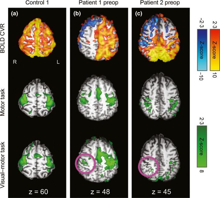 https://cdn.ncbi.nlm.nih.gov/pmc/blobs/b91e/5763346/2d4720eec6ef/CPF-38-87-g002.jpg