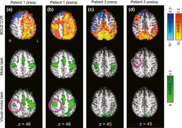 https://cdn.ncbi.nlm.nih.gov/pmc/blobs/b91e/5763346/7ab53cc0f242/CPF-38-87-g004.jpg