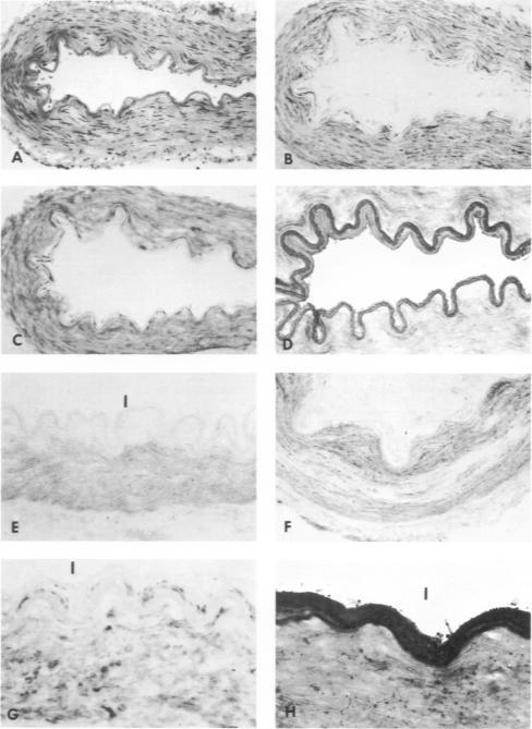 https://cdn.ncbi.nlm.nih.gov/pmc/blobs/b91f/2032742/e38f13735a17/amjpathol00548-0197-a.jpg