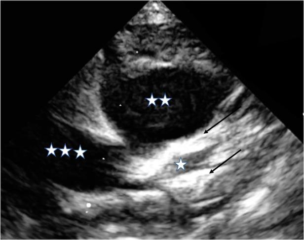 https://cdn.ncbi.nlm.nih.gov/pmc/blobs/b929/10419265/1464272aea82/fped-11-1210940-g001.jpg