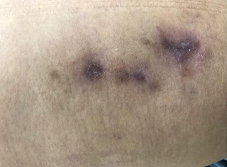 https://cdn.ncbi.nlm.nih.gov/pmc/blobs/b92c/6375268/37454c60acfb/jvb-17-04-341-g07.jpg