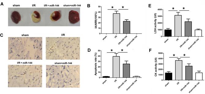 https://cdn.ncbi.nlm.nih.gov/pmc/blobs/b937/6364149/24a99c2dc048/etm-17-03-2152-g01.jpg