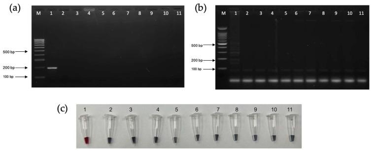 https://cdn.ncbi.nlm.nih.gov/pmc/blobs/b93f/11507355/9896f2a273a8/diagnostics-14-02323-g009.jpg