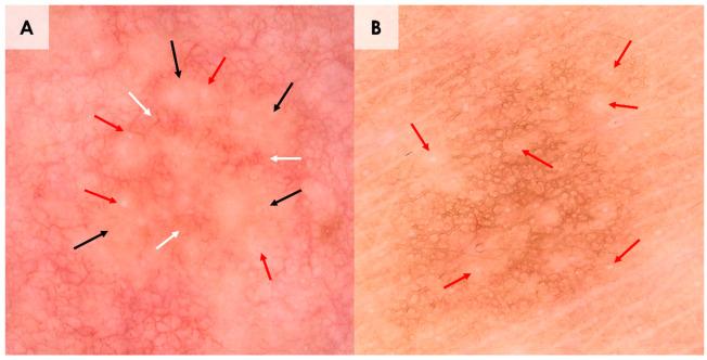 https://cdn.ncbi.nlm.nih.gov/pmc/blobs/b942/11719844/41608a7a6c09/diagnostics-15-00110-g002.jpg