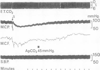 https://cdn.ncbi.nlm.nih.gov/pmc/blobs/b95a/496239/262e94c45cba/jnnpsyc00240-0020-a.jpg