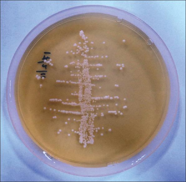 https://cdn.ncbi.nlm.nih.gov/pmc/blobs/b95d/5596688/317b081756eb/JOMFP-21-316-g002.jpg