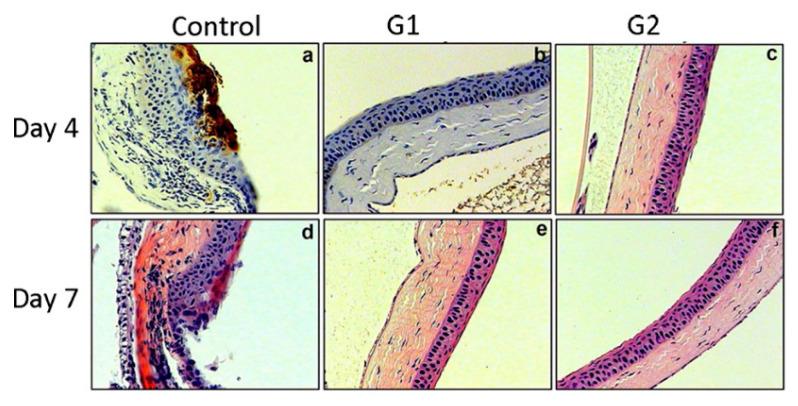 https://cdn.ncbi.nlm.nih.gov/pmc/blobs/b95f/7821943/6790e153a18d/pharmaceutics-13-00001-g004.jpg