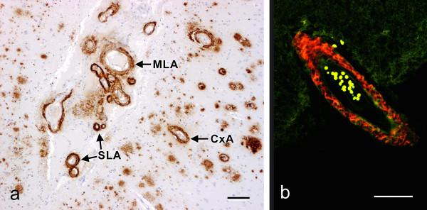 https://cdn.ncbi.nlm.nih.gov/pmc/blobs/b961/2874258/58573e6663bd/alzrt6-1.jpg