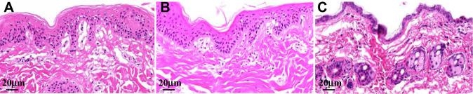 https://cdn.ncbi.nlm.nih.gov/pmc/blobs/b963/9464638/e9b33107e9ce/IJN-17-4009-g0006.jpg