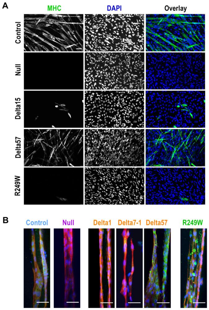 https://cdn.ncbi.nlm.nih.gov/pmc/blobs/b964/7291140/7b4bcc171394/cells-09-01286-g004.jpg