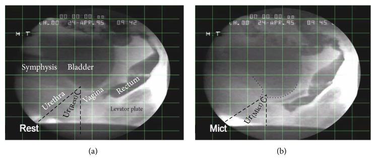 https://cdn.ncbi.nlm.nih.gov/pmc/blobs/b96c/5820624/e8429c1bb3cf/CMMM2018-9518076.006.jpg