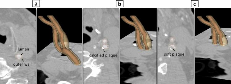 https://cdn.ncbi.nlm.nih.gov/pmc/blobs/b96d/11251049/4dd740065bb2/41598_2024_66777_Fig1_HTML.jpg