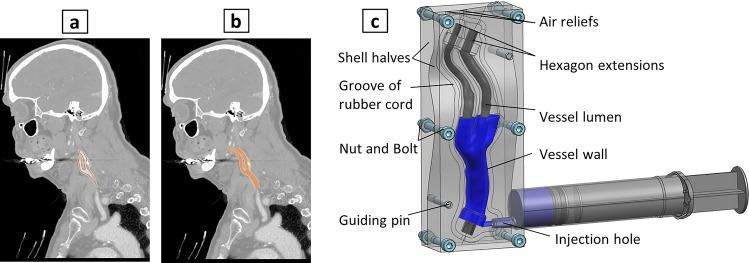 https://cdn.ncbi.nlm.nih.gov/pmc/blobs/b96d/11251049/92615d9cd932/41598_2024_66777_Fig2_HTML.jpg