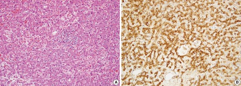 https://cdn.ncbi.nlm.nih.gov/pmc/blobs/b96d/3830987/edc7a62a8c6d/kjpathol-47-411-g002.jpg