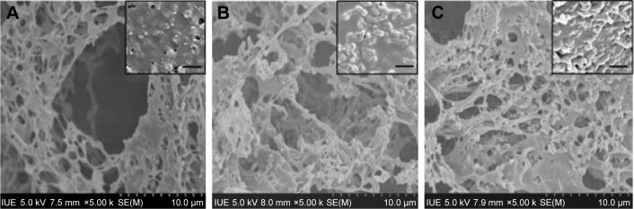 https://cdn.ncbi.nlm.nih.gov/pmc/blobs/b972/5352233/0c3b992dde64/ijn-12-1877Fig3.jpg