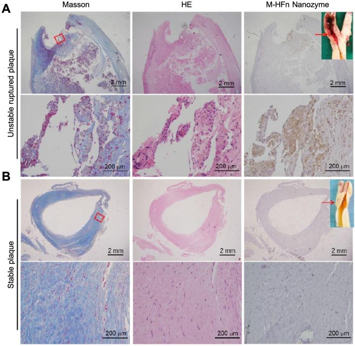 https://cdn.ncbi.nlm.nih.gov/pmc/blobs/b972/6929972/4ac0ebcac0c4/thnov10p0687g009.jpg