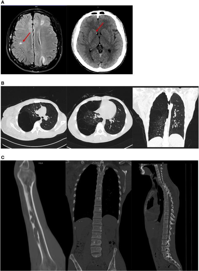 https://cdn.ncbi.nlm.nih.gov/pmc/blobs/b979/9731334/a4a4e9b8d550/fonc-12-1007651-g003.jpg