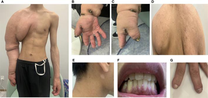 https://cdn.ncbi.nlm.nih.gov/pmc/blobs/b979/9731334/ac14cbeb8109/fonc-12-1007651-g002.jpg